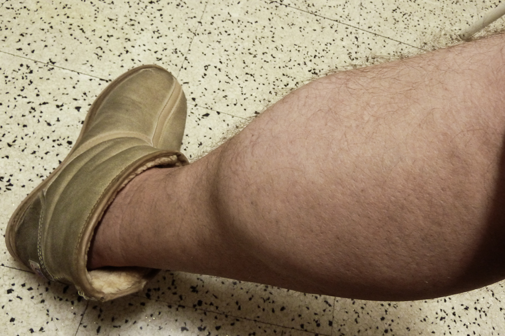 large-calf-muscle