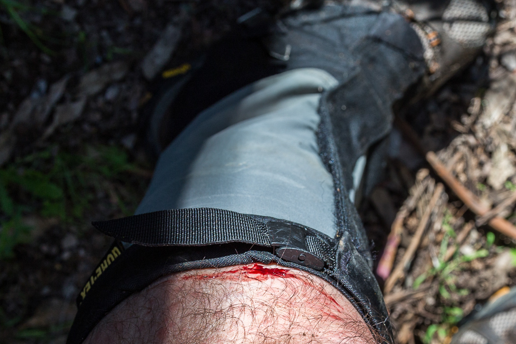 cut-leg-whilst-hiking