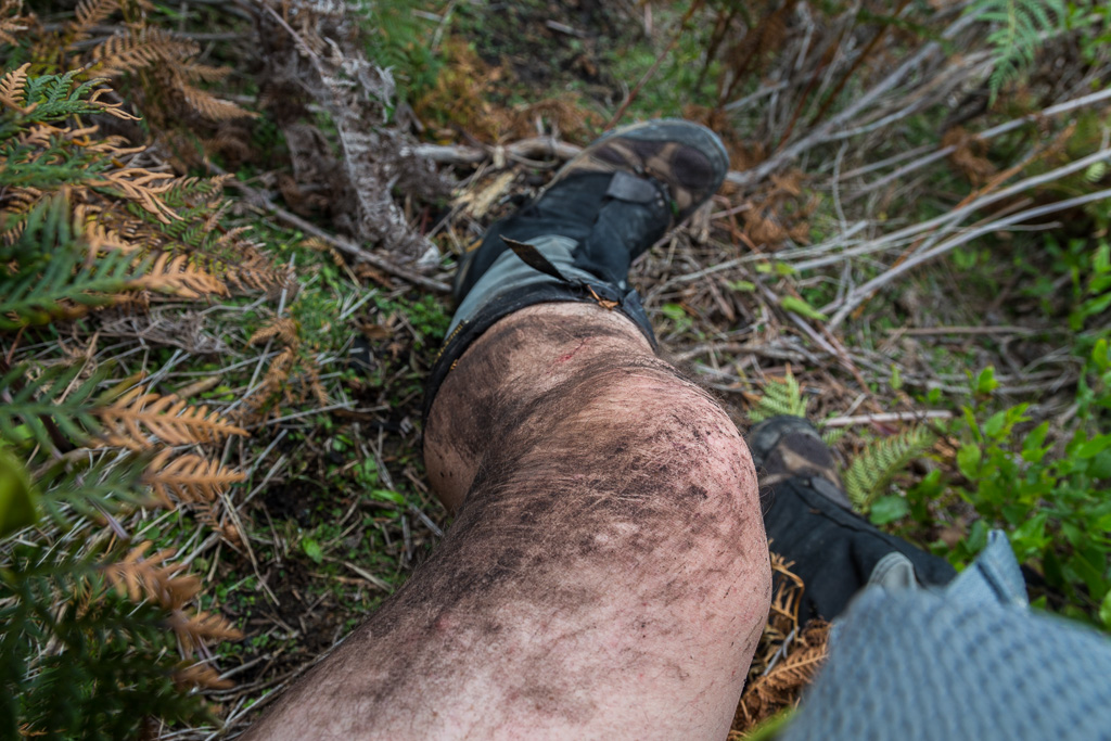 mud-on-leg-after-falling