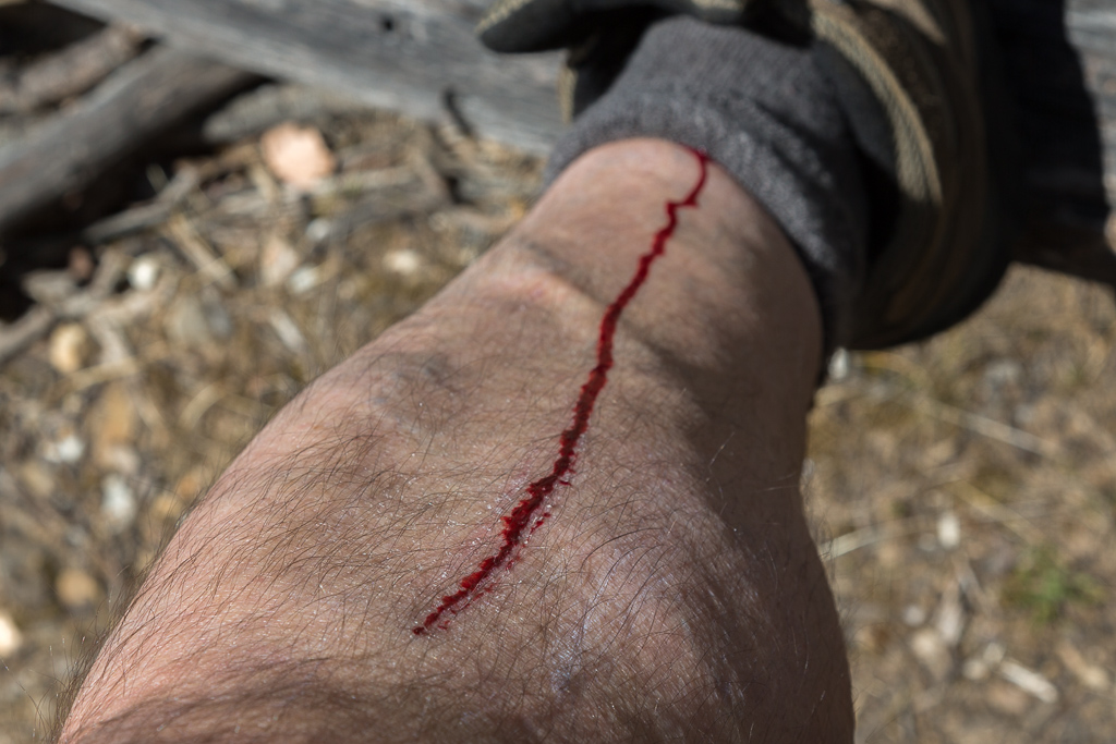 cut-front-of-leg-bleeding