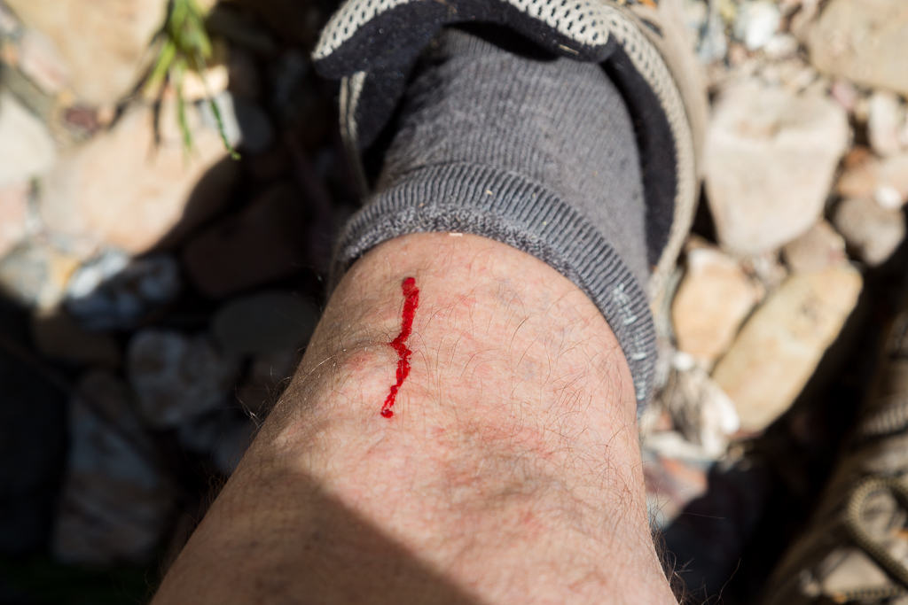 bleeding-leg-hiking