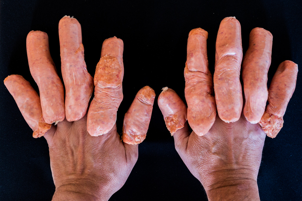 sausage-fingers